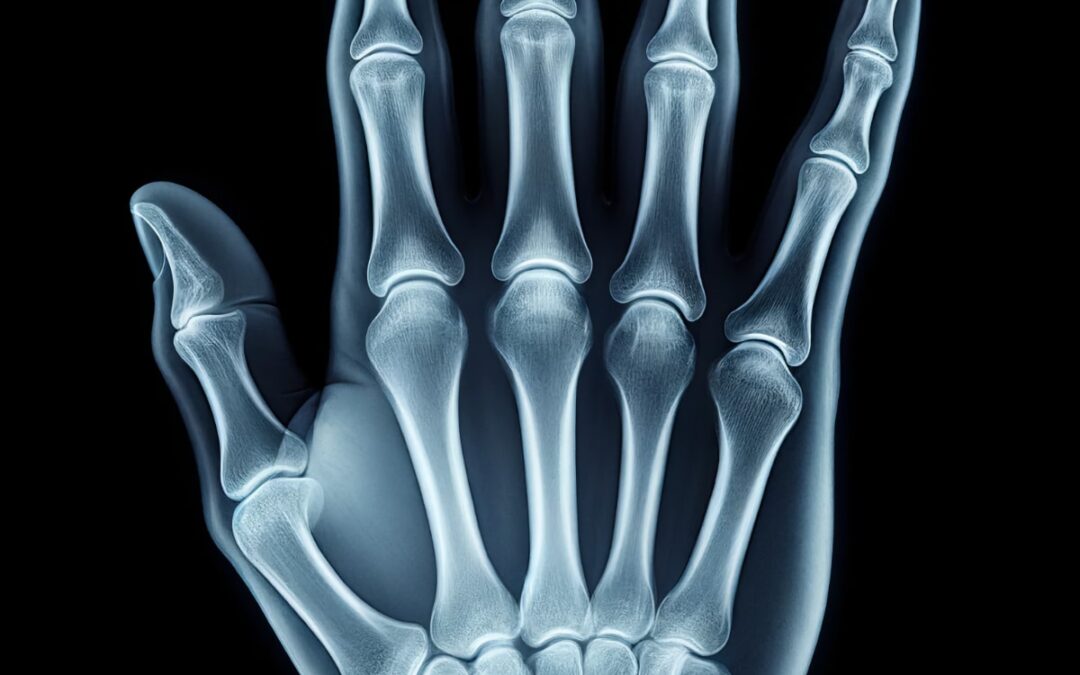 Osteoarthritis vs. Arthritis: Unraveling the Differences Between Two Common Joint Diseases